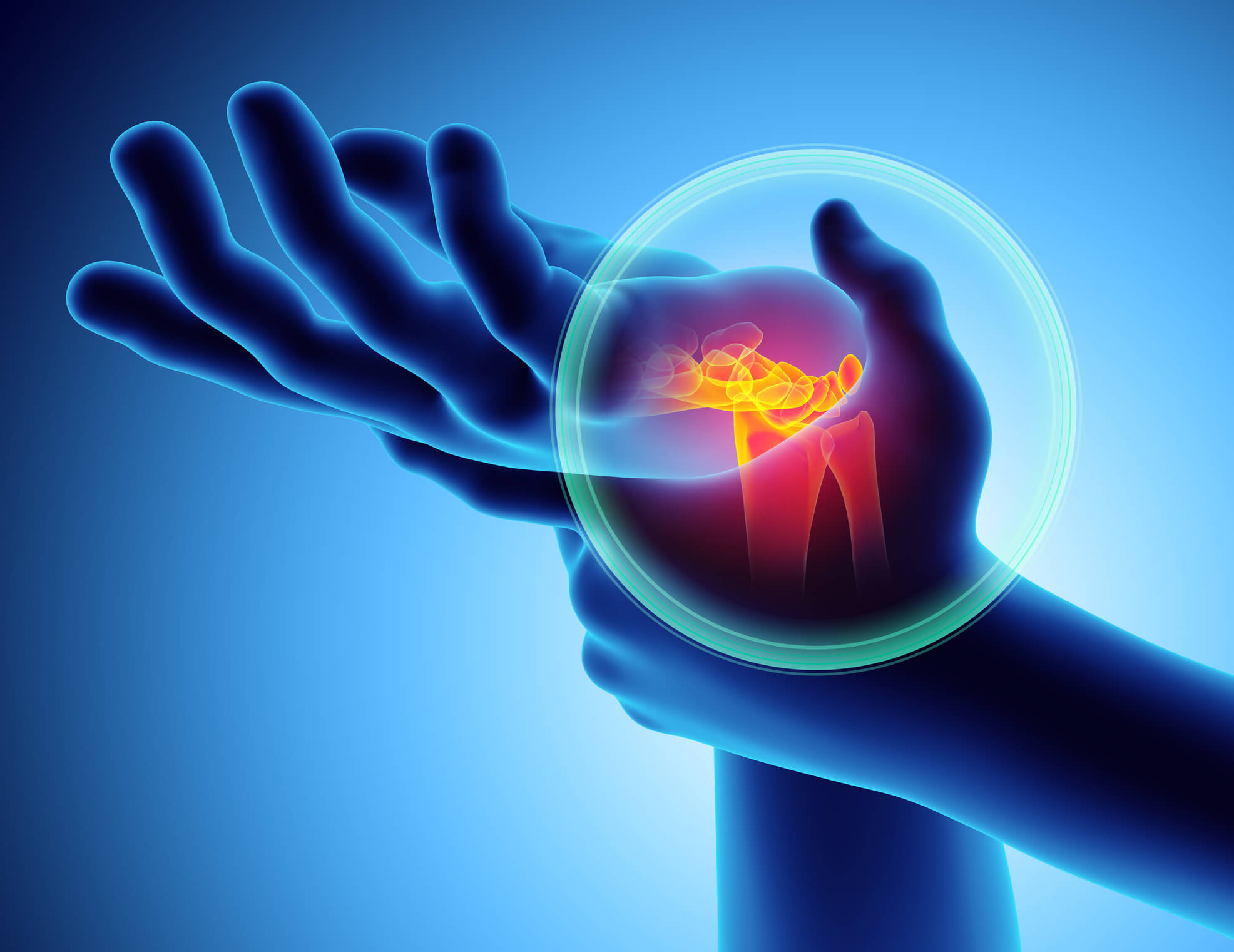 Top Five Gifts that Provide Relief for Carpal Tunnel Sufferers - The  Personal Injury Center