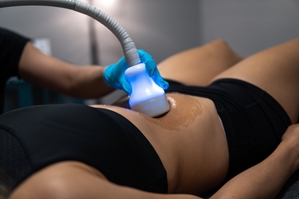 Picture of  pHFat Removal